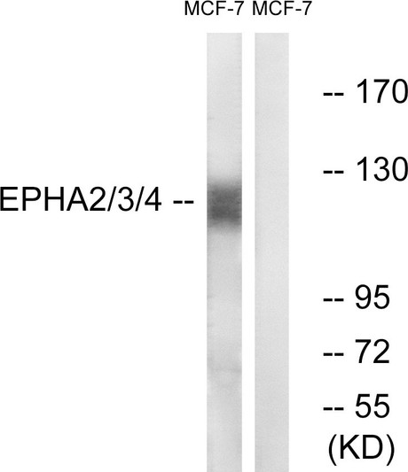 Western blot analysis of lysates from MCF-7 cells, using EPHA2/3/4 Antibody. The lane on the right is blocked with the synthesized peptide.
