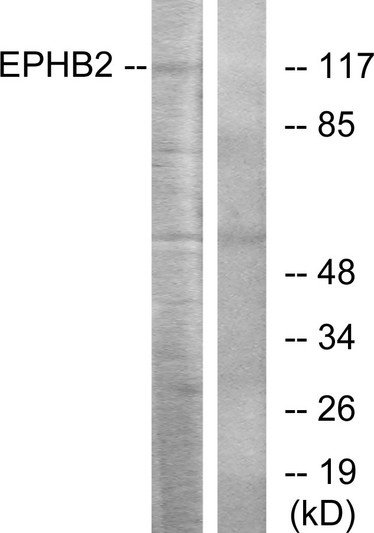 Western blot analysis of lysates from Jurkat cells, using EPHB2 Antibody. The lane on the right is blocked with the synthesized peptide.