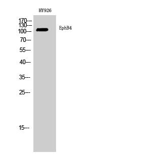 Western blot analysis of HY926 cells using EphB4 polyclonal antibody diluted at 1:2000 STJ92952