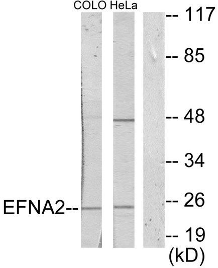 Western blot analysis of lysates from HeLa and COLO205 cells, using EFNA2 Antibody. The lane on the right is blocked with the synthesized peptide.
