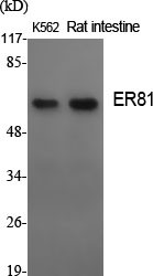Western blot analysis of various cells using ER81 polyclonal antibody on cells' nuclei extracted by Minute™ cytoplasmic STJ92969