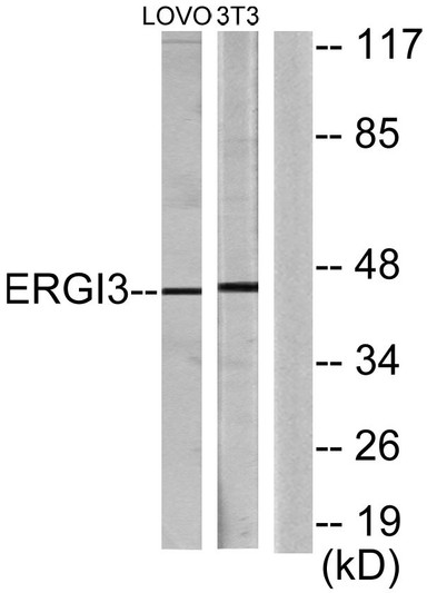 Western blot analysis of lysates from LOVO and NIH/3T3 cells, using ERGI3 Antibody. The lane on the right was blocked STJ92985
