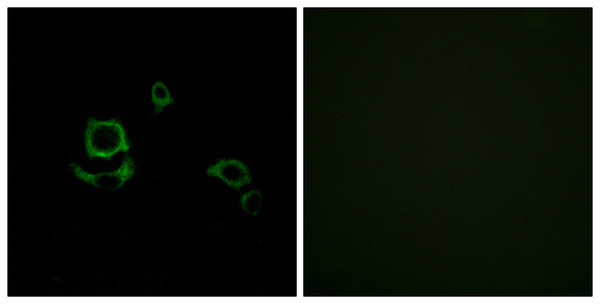 Immunofluorescence analysis of HUVEC cells, using F13B Antibody. The picture on the right is blocked with the synthesized peptide. Immunofluorescence analysis of HUVEC cells, using F13B Antibody. The picture on the right is blocked with the synthesized peptide.