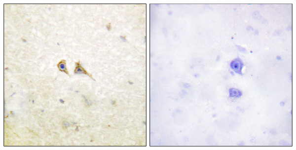 Immunohistochemistry analysis of paraffin-embedded human brain tissue, using FAS ligand Antibody. The picture on the right is blocked with the synthesized peptide.