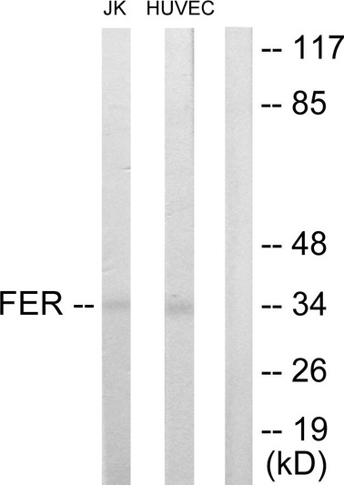 Western blot analysis of lysates from Jurkat and HUVEC cells, using FER Antibody. The lane on the right is blocked with the synthesized peptide.