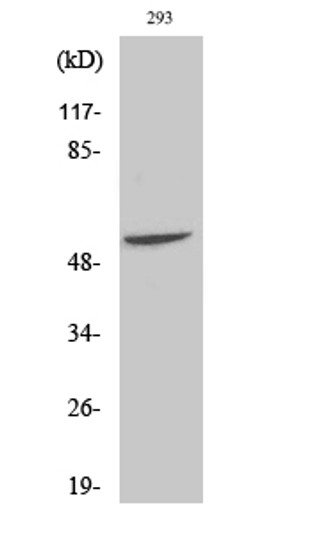 Western blot analysis of various cells using Fgl2 Polyclonal Antibody
