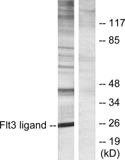 Western blot analysis of lysates from Jurkat cells, using Flt3 ligand Antibody. The lane on the right is blocked with the synthesized peptide.