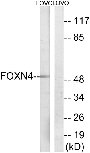 Western blot analysis of lysates from LOVO cells, using FOXN4 Antibody. The lane on the right is blocked with the synthesized peptide.