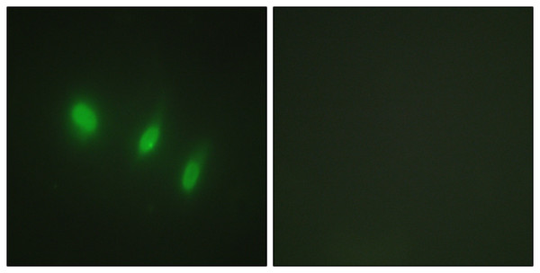 Immunofluorescence analysis of HeLa cells, using FOXO4 Antibody. The picture on the right is blocked with the synthesized peptide.