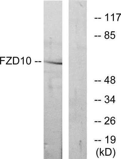 Western blot analysis of lysates from COS7 cells, using FZD10 Antibody. The lane on the right is blocked with the synthesized peptide.