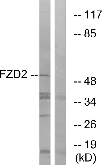 Western blot analysis of lysates from HeLa cells, using FZD2 Antibody. The lane on the right is blocked with the synthesized peptide.