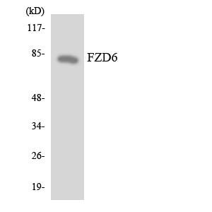 Western blot analysis of the lysates from 293 cells using FZD6 antibody.