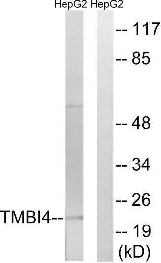Western blot analysis of lysates from HepG2 cells, using TMBIM4 Antibody. The lane on the right is blocked with the synthesized peptide.
