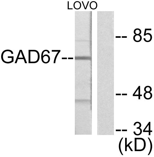 Western blot analysis of lysates from LOVO cells, using GAD1 Antibody. The lane on the right is blocked with the synthesized peptide.