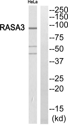 Western blot analysis of RASA3 Antibody. The lane on the right is blocked with the RASA3 peptide.