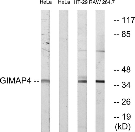 Western blot analysis of lysates from HeLa, HT-29, and RAW264.7 cells, using GIMAP4 Antibody. The lane on the right is blocked with the synthesized peptide.