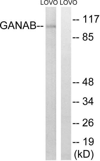 Western blot analysis of lysates from LOVO cells, using GANAB Antibody. The lane on the right is blocked with the synthesized peptide.