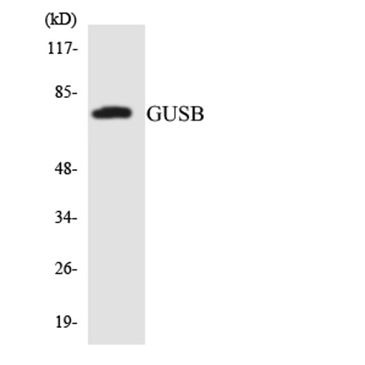 Western blot analysis of the lysates from COLO205 cells using GUSB antibody.