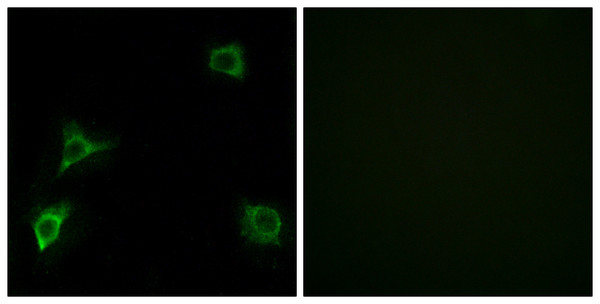 Immunofluorescence analysis of HUVEC cells, using GRID2 Antibody. The picture on the right is blocked with the synthesized peptide.