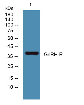 Western blot analysis of lysates from A431 cells, primary antibody was diluted at 1:1000, 4°C over night
