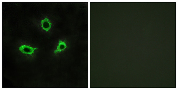 Immunofluorescence analysis of LOVO cells, using GPR115 Antibody. The picture on the right is blocked with the synthesized peptide.