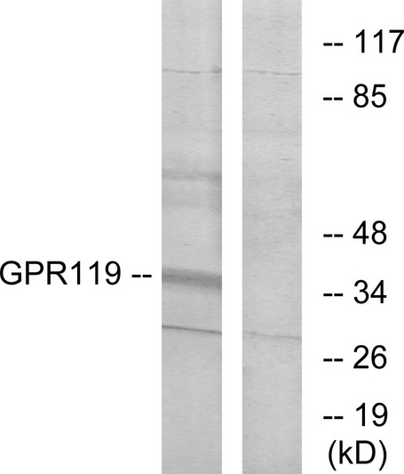 Western blot analysis of lysates from K562 cells, using GPR119 Antibody. The lane on the right is blocked with the synthesized peptide. Western blot analysis of lysates from K562 cells, using GPR119 Antibody. The lane on the right is blocked with the synthesized peptide.