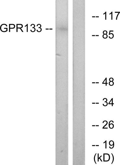 Western blot analysis of lysates from COS7 cells, using GPR133 Antibody. The lane on the right is blocked with the synthesized peptide.