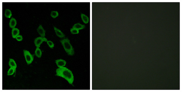 Immunofluorescence analysis of LOVO cells, using GPR139 Antibody. The picture on the right is blocked with the synthesized peptide. Immunofluorescence analysis of LOVO cells, using GPR139 Antibody. The picture on the right is blocked with the synthesized peptide.