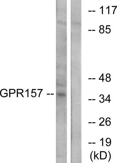 Western blot analysis of lysates from NIH/3T3 cells, using GPR157 Antibody. The lane on the right is blocked with the synthesized peptide.