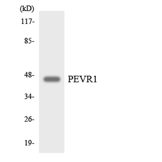 Western blot analysis of the lysates from HepG2 cells using PEVR1 antibody.