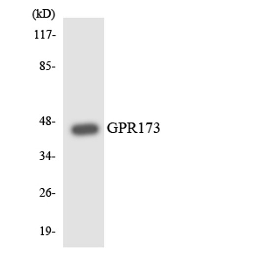 Western blot analysis of the lysates from COLO205 cells using GPR173 antibody. Western blot analysis of the lysates from COLO205 cells using GPR173 antibody.