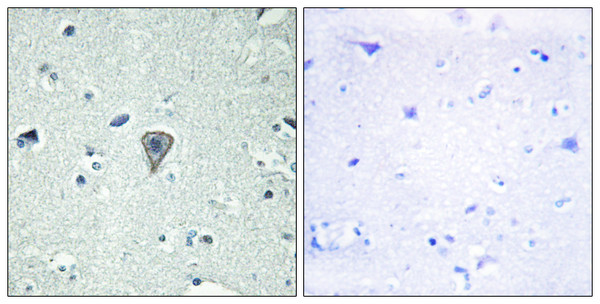Immunohistochemistry analysis of paraffin-embedded human brain tissue, using ETBR2 Antibody. The picture on the right is blocked with the synthesized peptide.