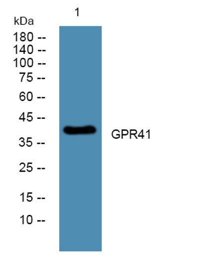 Western blot analysis of lysates from U2OS cells, primary antibody was diluted at 1:1000, 4°C over night