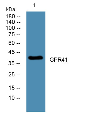 Western blot analysis of lysates from U2OS cells, primary antibody was diluted at 1:1000, 4°C overnight STJ93385