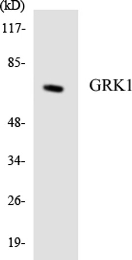 Western blot analysis of the lysates from Jurkat cells using GRK1 antibody.