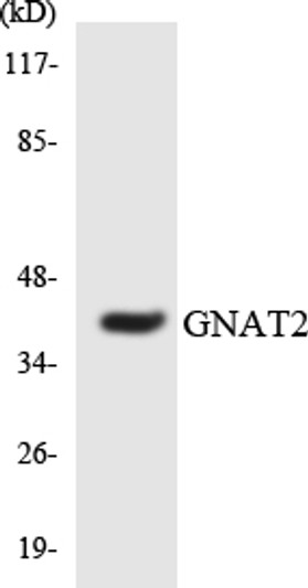 Western blot analysis of the lysates from Jurkat cells using GNAT2 antibody. Western blot analysis of the lysates from Jurkat cells using GNAT2 antibody.