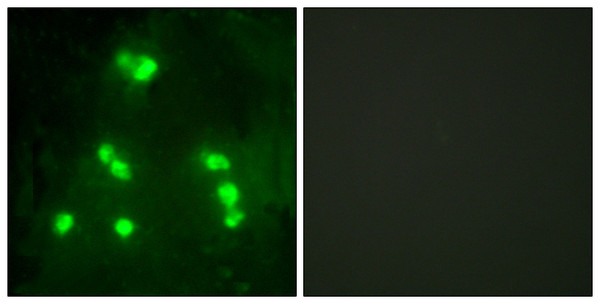 Immunofluorescence analysis of A549 cells, using HAIR Antibody. The picture on the right is blocked with the synthesized peptide. Immunofluorescence analysis of A549 cells, using HAIR Antibody. The picture on the right is blocked with the synthesized peptide.