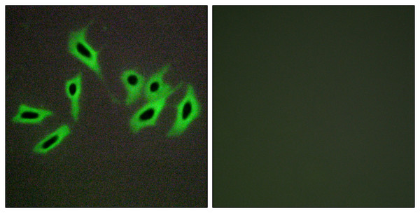 Immunofluorescence analysis of HepG2 cells, using Heparin Cofactor II Antibody. The picture on the right is blocked with the synthesized peptide.