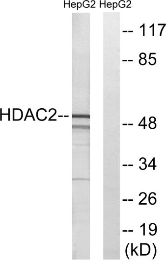 Western blot analysis of lysates from HepG2 cells, using HDAC2 Antibody. The lane on the right is blocked with the synthesized peptide. Western blot analysis of lysates from HepG2 cells, using HDAC2 Antibody. The lane on the right is blocked with the synthesized peptide.