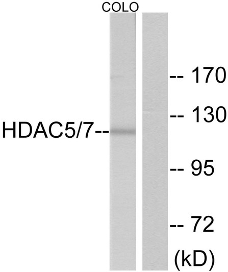 Western blot analysis of lysates from colo cells, using HDAC5 Antibody. The lane on the right is blocked with the synthesized peptide.