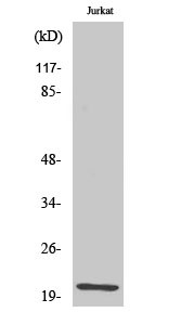 Western blot analysis of various cells using HEN1/2 Polyclonal Antibody diluted at 1:1000. Cells' nucleus extracted by STJ93490