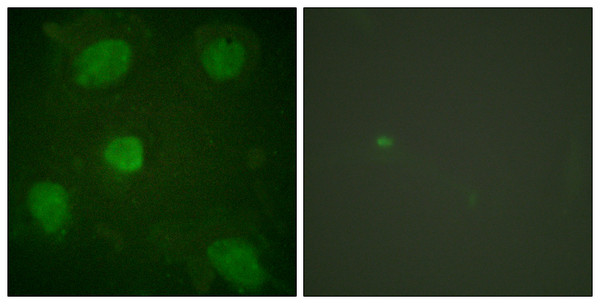 Immunofluorescence analysis of HeLa cells, using Hic-5 Antibody. The picture on the right is blocked with the synthesized peptide.