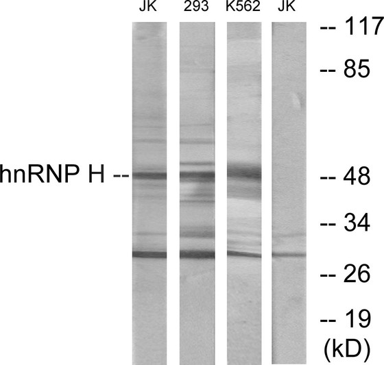 Western blot analysis of lysates from Jurkat, 293, and K562 cells, using hnRNP H Antibody. The lane on the right is blocked with the synthesized peptide.