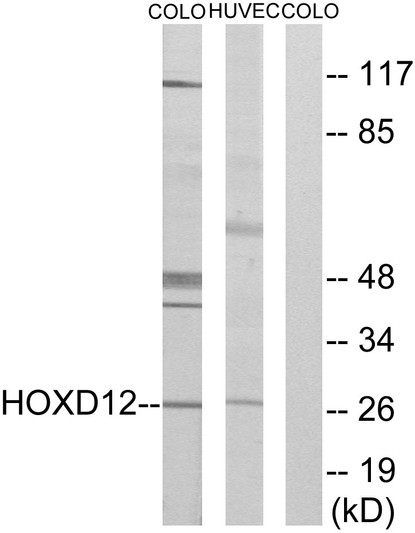 Western blot analysis of lysates from COLO205 and HucEc cells, treated with serum 20% 15', using HOXD12 Antibody. The lane on the right is blocked with the synthesized peptide. Western blot analysis of lysates from COLO205 and HucEc cells, treated with serum 20% 15', using HOXD12 Antibody. The lane on the right is blocked with the synthesized peptide.
