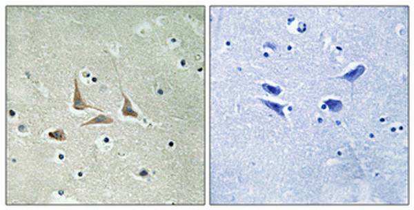 Immunohistochemical analysis of paraffin-embedded Human brain. Antibody was diluted at 1:100 (4°C overnight). High-pressure and temperature Tris-EDTA, pH8.0 was used for antigen retrieval. Negetive contrl (right) obtaned from antibody was pre-absorbed by immunogen peptide.