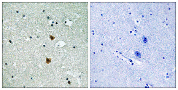Immunohistochemistry analysis of paraffin-embedded human brain tissue, using HSP27 Antibody. The picture on the right is blocked with the synthesized peptide.