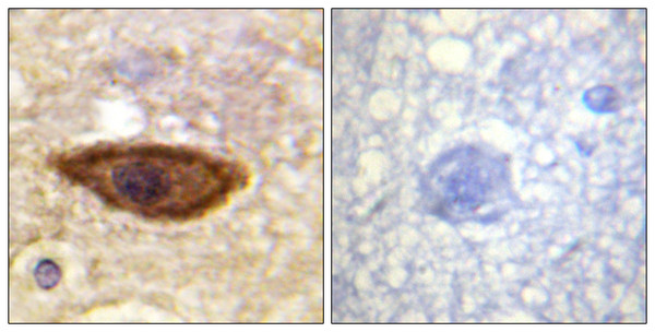 Immunohistochemistry analysis of paraffin-embedded human brain tissue, using Interferon-alpha/beta Receptor alpha chain Antibody. The picture on the right is blocked with the synthesized peptide.