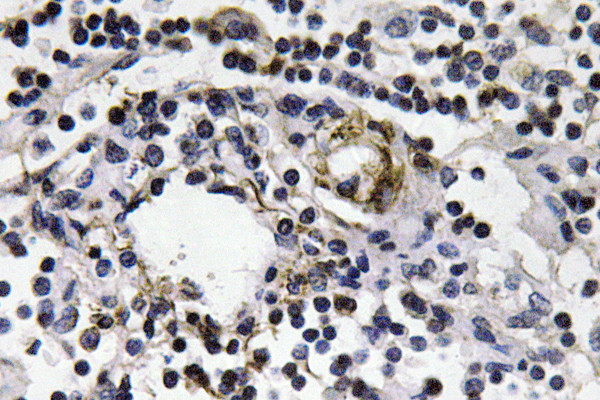 Immunohistochemistry analysis of IFN-Gamma antibody in paraffin-embedded human lymph node tissue.