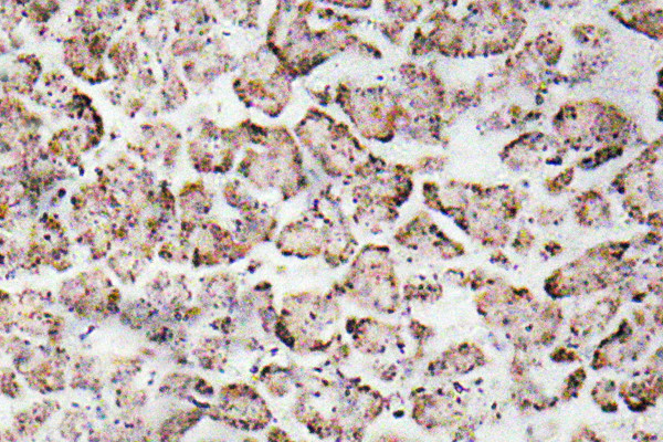 Immunohistochemistry analysis of IGF-I antibody in paraffin-embedded human pancreas tissue.