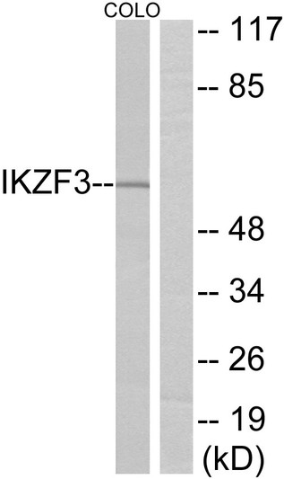 Western blot analysis of lysates from COLO cells, using IKZF3 Antibody. The lane on the right is blocked with the synthesized peptide. Western blot analysis of lysates from COLO cells, using IKZF3 Antibody. The lane on the right is blocked with the synthesized peptide.